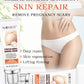 Remove Pregnancy Scars Acne Cream Stretch Mark Treatment Maternity Repair Anti-Aging Anti-Winkle Firming Body Cream