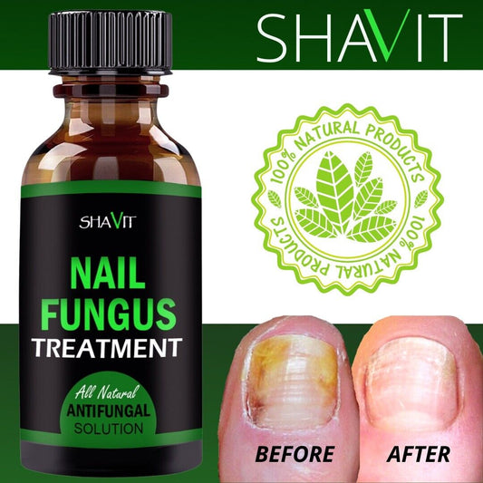 Anti-Fungal Serum | Advance Anti-Fungal Serum | Trend N Trove