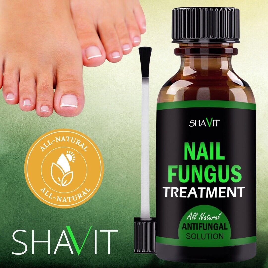 Anti-Fungal Serum | Advance Anti-Fungal Serum | Trend N Trove