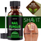 Anti-Fungal Serum | Advance Anti-Fungal Serum | Trend N Trove