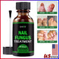 Anti-Fungal Serum | Advance Anti-Fungal Serum | Trend N Trove