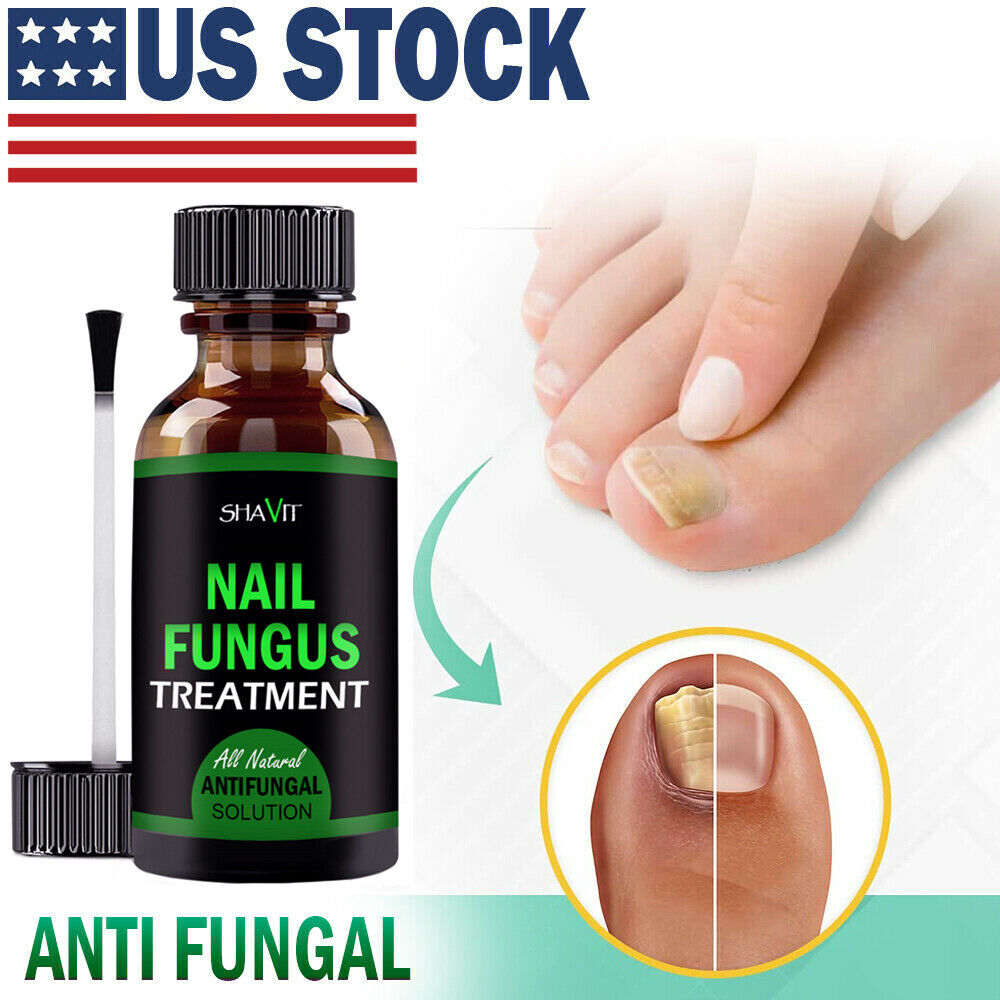 Anti-Fungal Serum | Advance Anti-Fungal Serum | Trend N Trove