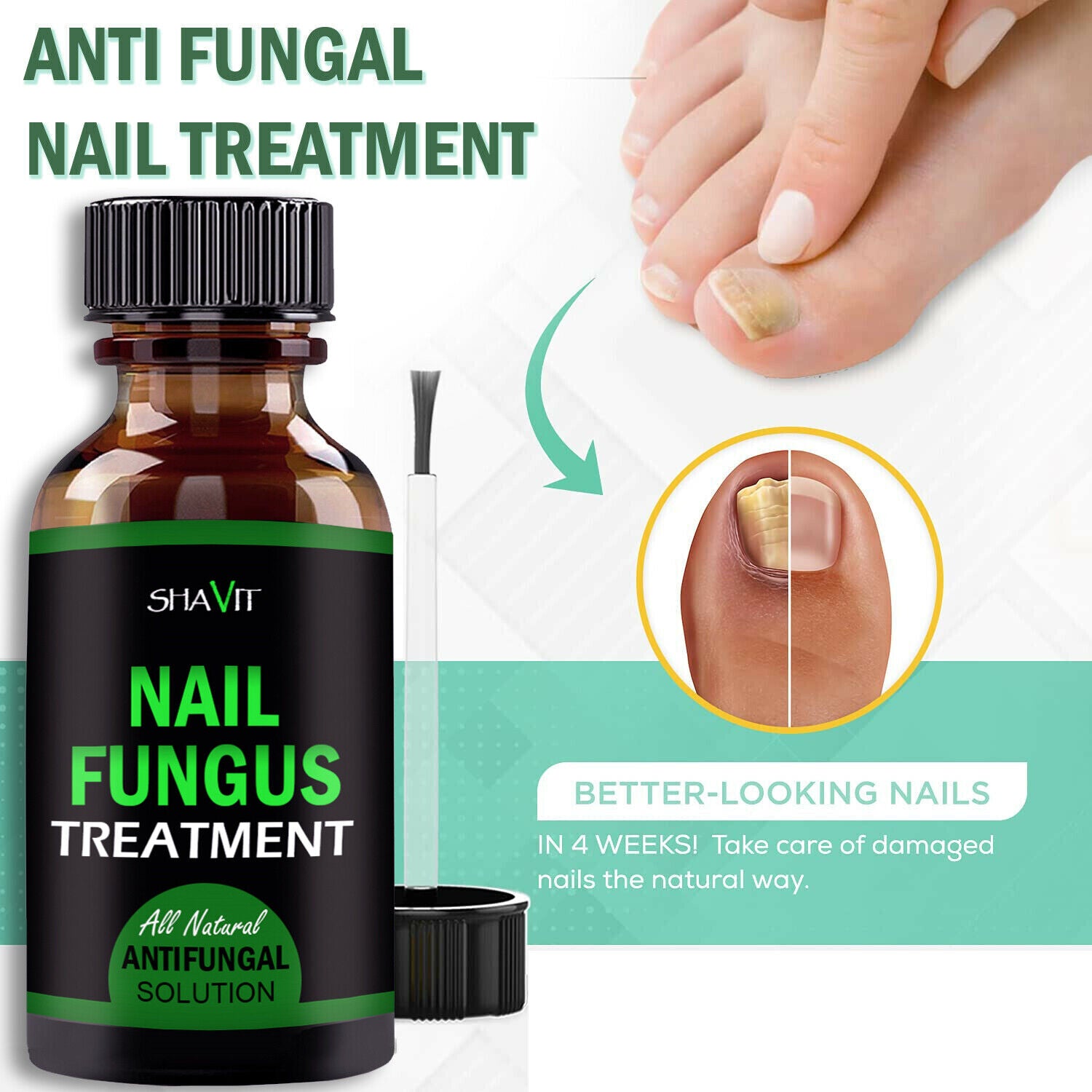 Anti-Fungal Serum | Advance Anti-Fungal Serum | Trend N Trove